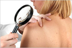 Hautkrebs-Früherkennungsuntersuchung. © fovito/Fotolia.com