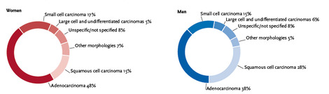 Distribution of malignant neoplasms of the lung by histological type and sex, ICD-10 C33–C34, Germany 2015–2016. Source: © German Centre for Cancer Registry Data at the Robert Koch Institute