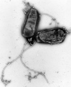 16.000-fach vergrößerte Darstellung eines Helicobacter pylori. Quelle: Hans R. Gelderblom / Robert Koch-Institut