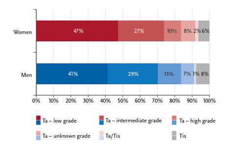 Distribution of non-invasive bladder tumours by tumour stage, grade and sex, ICD-10 D09.0 and D41.4, Germany 2015–2016. Source: © German Centre for Cancer Registry Data at the Robert Koch Institute